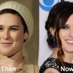 Rumer Willis Plastic Surgery Before and After Photos