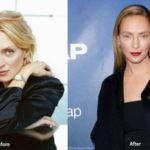 Uma Thurman Plastic Surgery Before and After Photos
