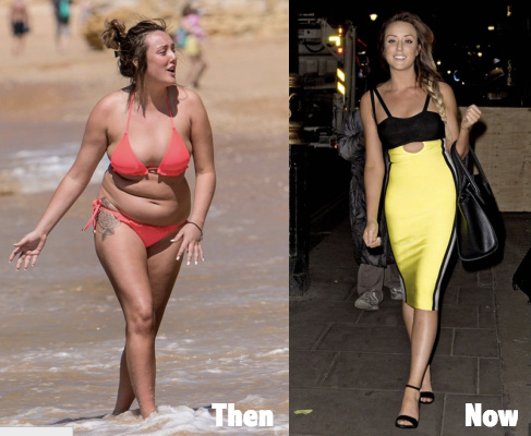 Charlotte Crosby Plastic Surgery before and after - Latest Plastic Surgery ...