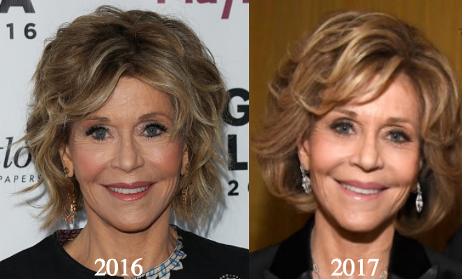Jane Fonda Plastic Surgery Before And After Photos Plastic Surgery ...