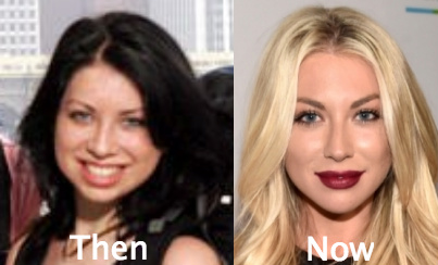 Stassi Schroeder Plastic Surgery Before and After Photos.