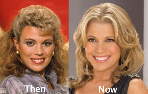 Vanna White plastic surgery rumors came about due to her youthful looks. 
