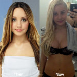 Amanda Bynes Plastic Surgery Before And After Photos