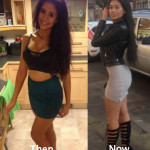 Chloe Ferry Plastic Surgery Before and After Photos