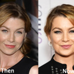 Ellen Pompeo Plastic Surgery Before and After Photos