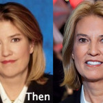 Greta Van Susteren Plastic Surgery Before and After Photos