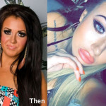 Holly Hagan Plastic Surgery Before and After Photos