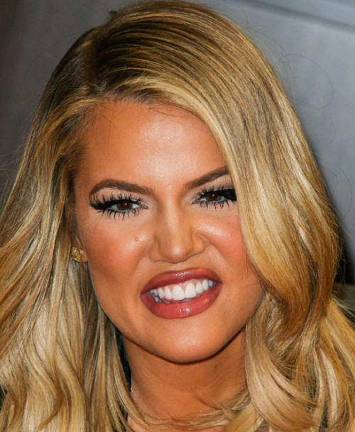 Khloe Kardashian Facial fillers gone wrong Latest Plastic Surgery