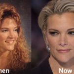 Megyn Kelly Plastic Surgery Before and After Photos
