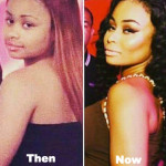 Blac Chyna Plastic Surgery Before and After Photos