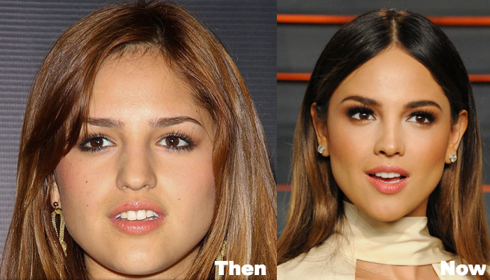 Eiza Gonzalez Plastic Surgery Before and After Photos.