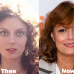 Susan Sarandon Plastic Surgery Before and After Photos