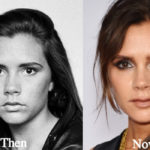 Victoria Beckham Plastic Surgery Before and After Photos