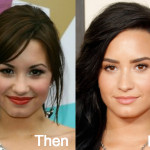 Demi Lovato Plastic Surgery Before and After Photos
