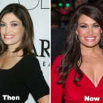 Kimberly Guilfoyle Plastic Surgery Before and After Photos