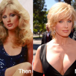 Morgan Fairchild Plastic Surgery Before and After Photos
