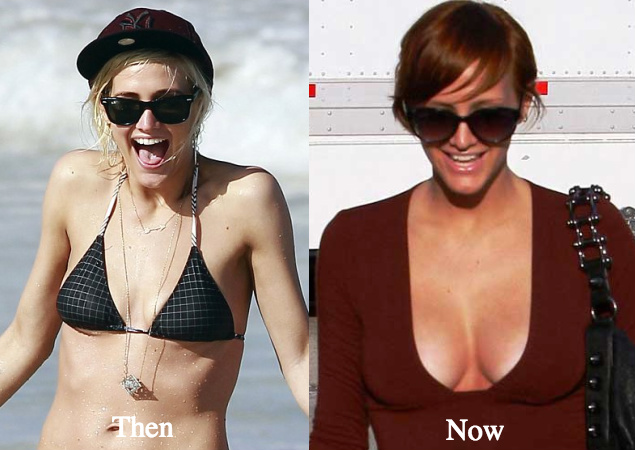 Ashlee Simpson boob job before and after - Latest Plastic Surgery Gossip An...