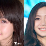 Angelababy Plastic Surgery Before and After Photos