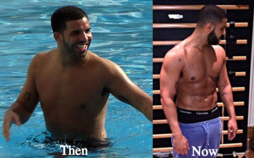 Drake Plastic Surgery Before and After Photos
