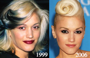 Gwen Stefani Plastic Surgery Before and After Photos