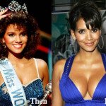 Halle Berry Plastic Surgery Before and After Photos