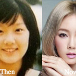 Taeyeon Plastic Surgery Before and After Photos