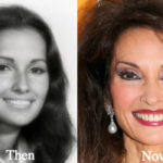 Susan Lucci Plastic Surgery Before and After Photos