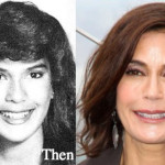 Teri Hatcher Plastic Surgery Before and After Photos