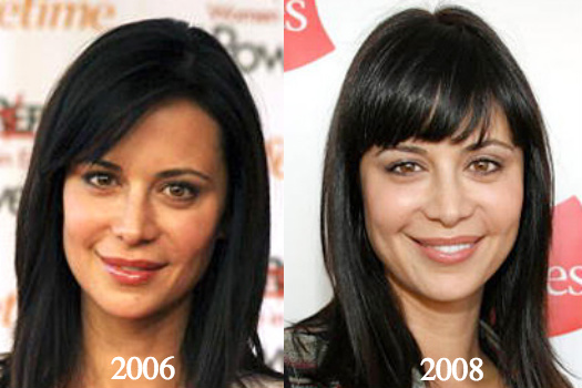 Catherine Bell 2006 2008 nose job - Latest Plastic Surgery Gossip And News....