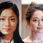 Lee Min Jung Plastic Surgery Before and After Photos