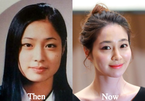 Lee Min Jung Plastic Surgery Before and After Photos - Latest Plastic Surge...