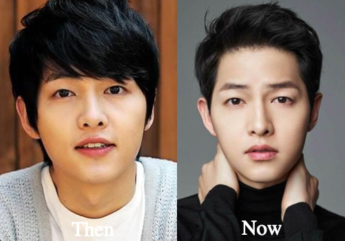 Song Joong Ki Plastic Surgery Before and After Photos. 