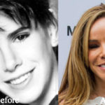 Melissa Rivers Plastic Surgery Before and After Photos