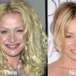 Portia de Rossi Plastic Surgery Before and After Photos