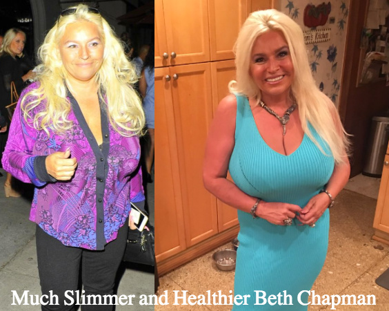 Beth Chapman Breasts Catches All Attention.