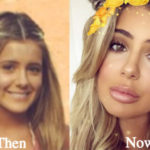 Brielle Biermann Plastic Surgery Before and After Photos