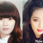 Hyuna Plastic Surgery Before and After Photos