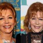 Joy Philbin Plastic Surgery Before and After Photos