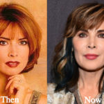Lauren Koslow Plastic Surgery Before and After Photos