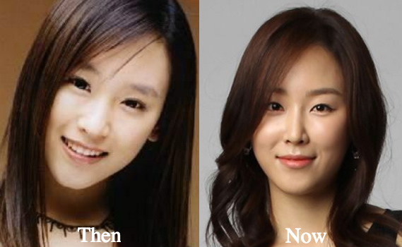 Seohyun Before And After