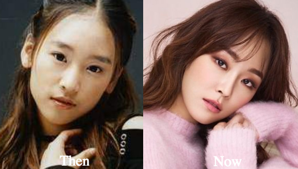 seo-hyun-jin-plastic-surgery-rumors-before-and-after-photos - Latest Plasti...
