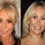 Kate Wright Plastic Surgery Rumors Before and After