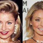 Kelly Ripa Plastic Surgery Before and After Photos