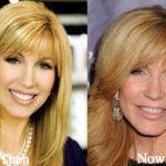 Leeza Gibbons Plastic Surgery Rumors Before and After Photos