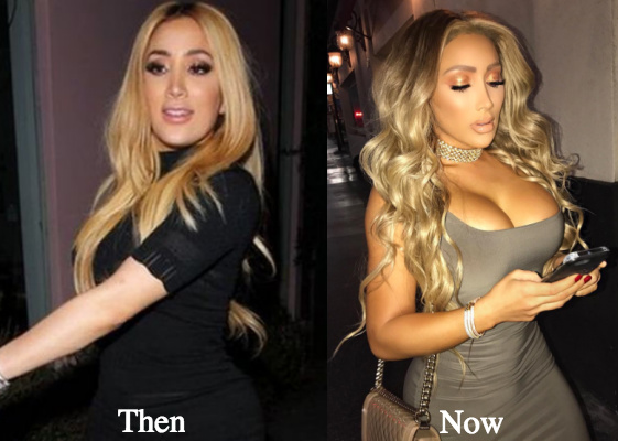 Nikki Mudarris (Nikkibaby) Before Plastic Surgery and After - Does she look...