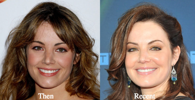 Erica Durance Plastic Surgery Before And After Photos Latest.