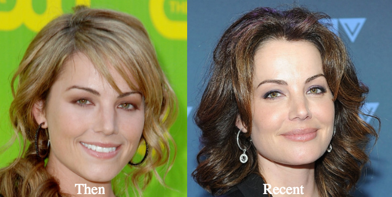 Erica Durance Plastic Surgery Before and After Photos - Latest Plastic...