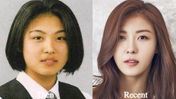 Did Ha Ji Won Undergo Plastic Surgery? 
