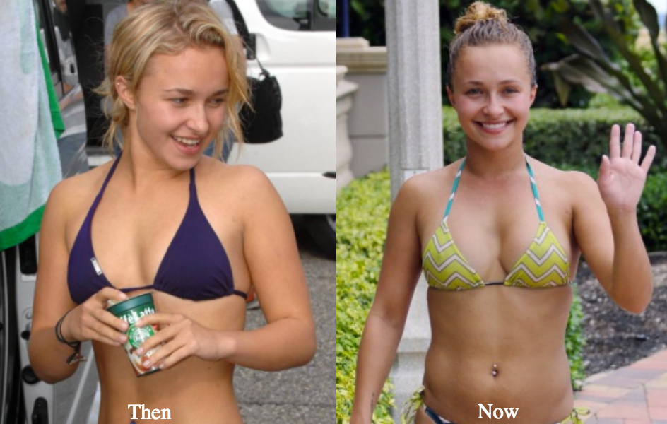hayden-panettiere-breast-implants-before-and-after - Latest Plastic Surgery...