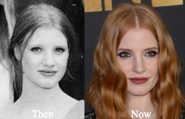 jessica-chastain-nose-job-before-and-after - Latest Plastic Surgery Gossip ...